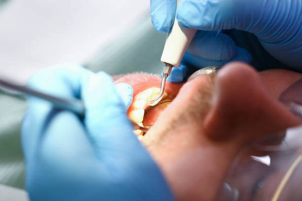 Best Emergency Orthodontic Repairs in Burke Centre, VA