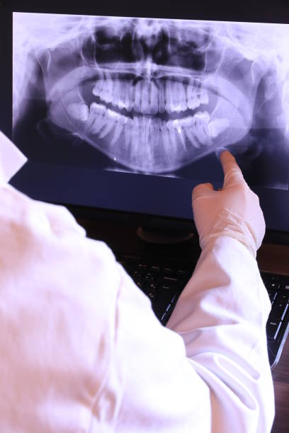 Best Emergency Wisdom Tooth Extraction in Burke Centre, VA