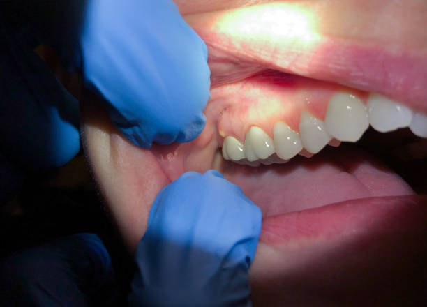 Best Weekend Emergency Dental Services in Burke Centre, VA