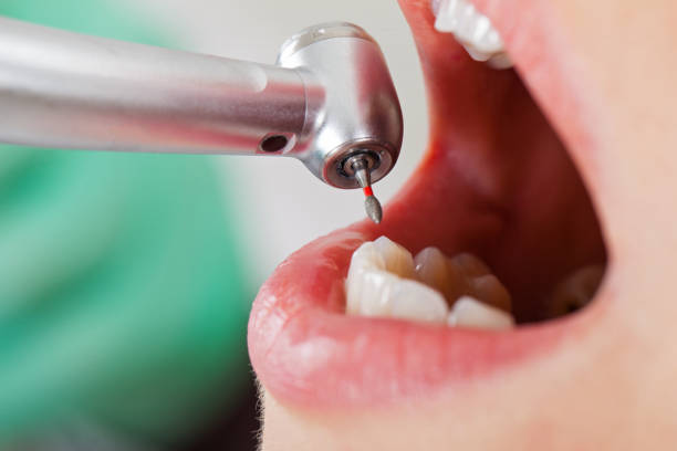 Best Urgent Dental Care for Toothaches in Burke Centre, VA